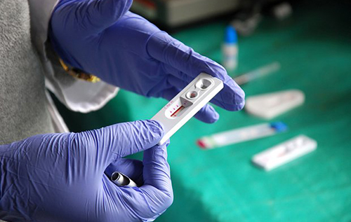 Розроблено нанопрепарат, який здатний заблокувати передачу ВІЛ при сексі