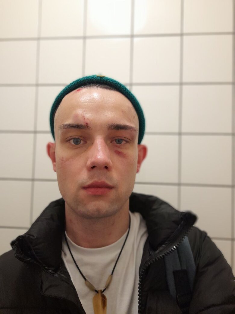 У Берліні побили українця через тризуб на шапці