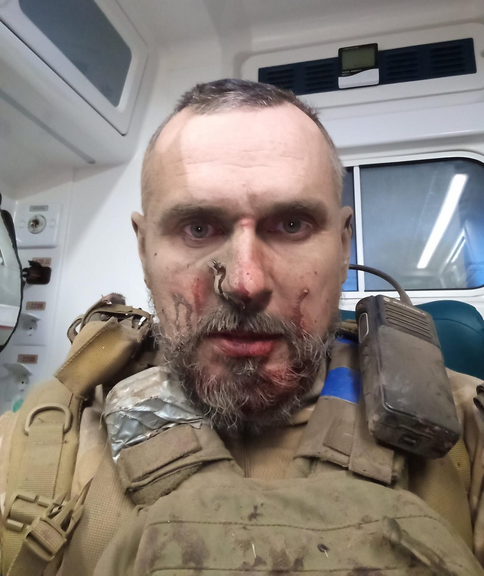 Олег Сенцов отримав поранення на фронті: "Бредлі знов врятував нам життя"
