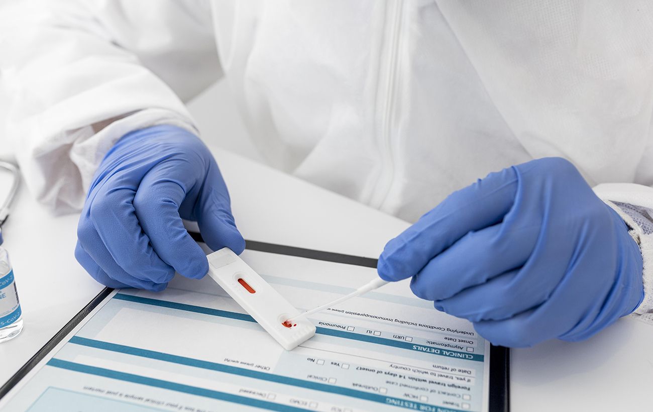У Франції забракували експрес-тест на коронавірус, поширений і в Україні