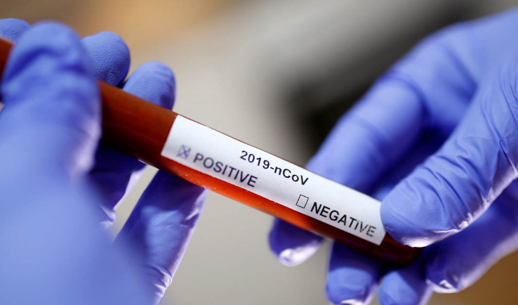 Перший випадок коронавірусу в Україні