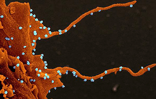 Ученые рассказали о "зловещих щупальцах" коронавируса