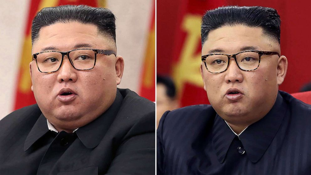 Поработали над имиджем: Ким Чен Ын похудел на 20 килограммов – разведка