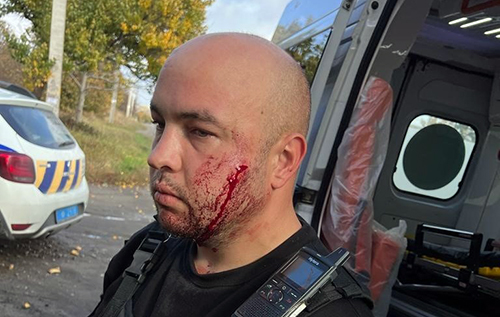 У Павлограді чоловік з ножем напав на поліцейських, одному з них довелося стріляти