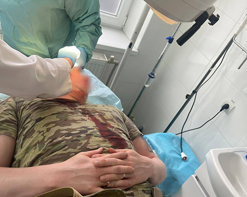 На Закарпатті у ромському поселенні стався напад на прикордонників: є поранені