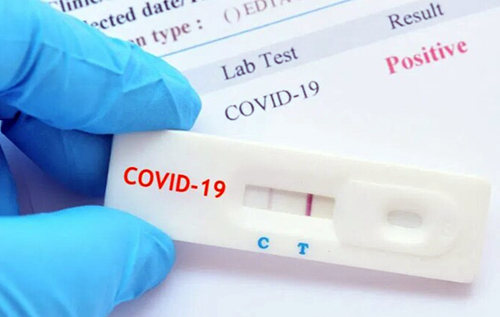 Нові штами COVID-19 в Україні: в ЦГЗ озвучили кількість випадків Stratus і Nimbus