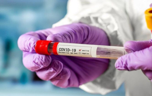 Тест на коронавірус в Україні: скільки коштує, де здати й за яких симптомів