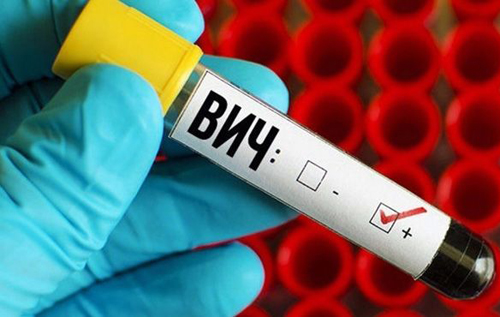 В США врачи 25 лет скрывали от ВИЧ-инфицированного мужчины его диагноз