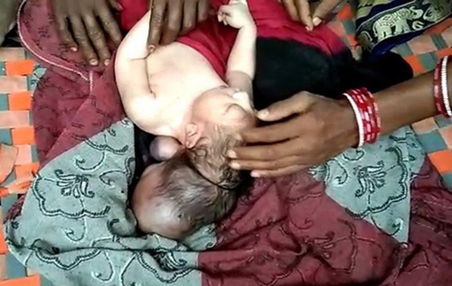 В Индии родился трехглавый младенец. Его односельчане решили, что он бог и устроили паломничество. ВИДЕО