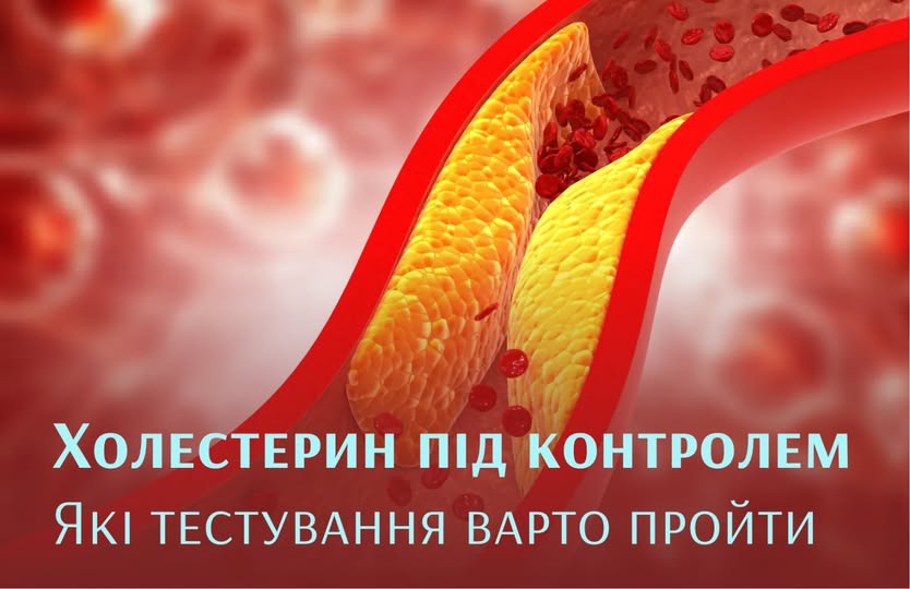 Коли починати контролювати рівень холестерину і як це робити 