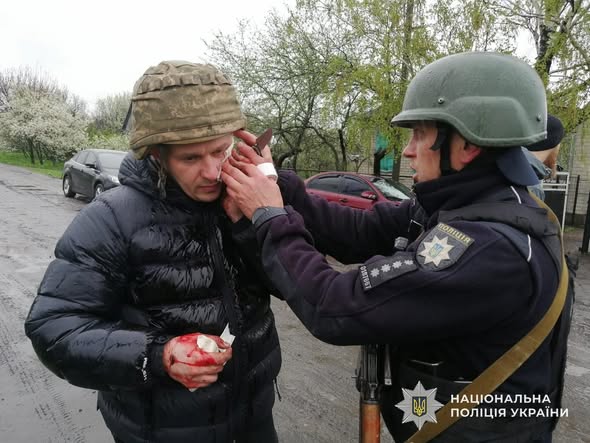 На Дніпропетровщині чоловік кинув гранату у поліцейських: є поранені