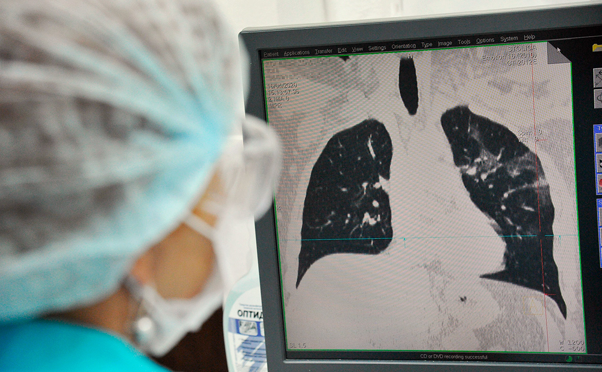 Лікар пояснила, чи можуть легені повністю відновитися після коронавірусу