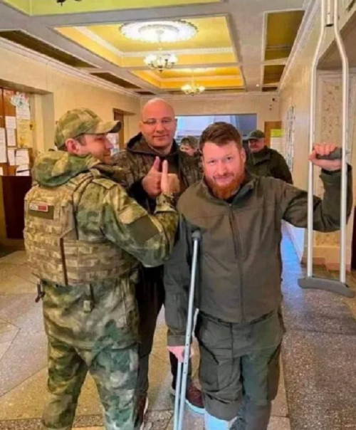Російський топ-пропагандист наступив на міну своїх же військ і втратив ногу