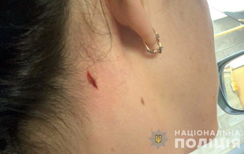 В Николаеве во время полицейских стрельб ранили женщину, которая выгуливала собак