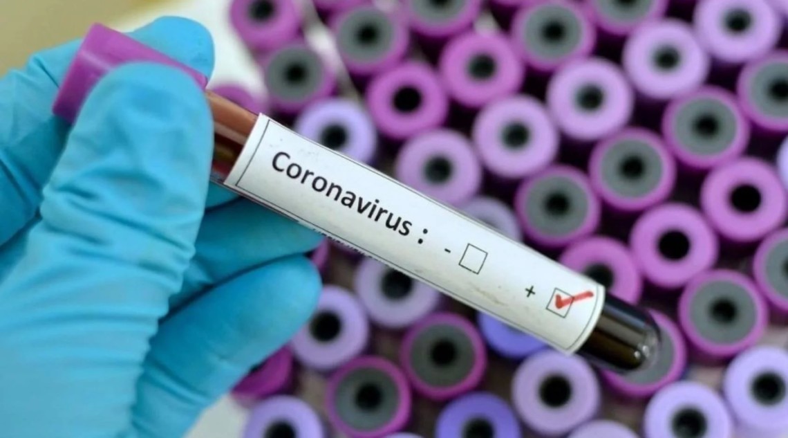 Коронавірус тест 