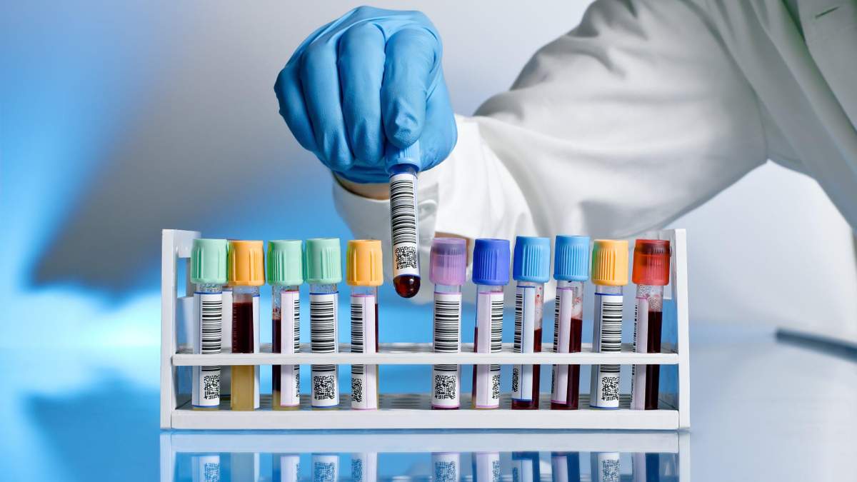 У людей з якою групою крові вищий ризик тромбозів?