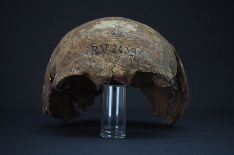 Нулевой пациент? В скелете, найденном в Латвии, нашли самый древний штамм чумы