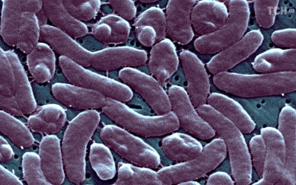 Вчені б'ють на сполох через збільшення кількості смертоносних бактерій: про що йдеться