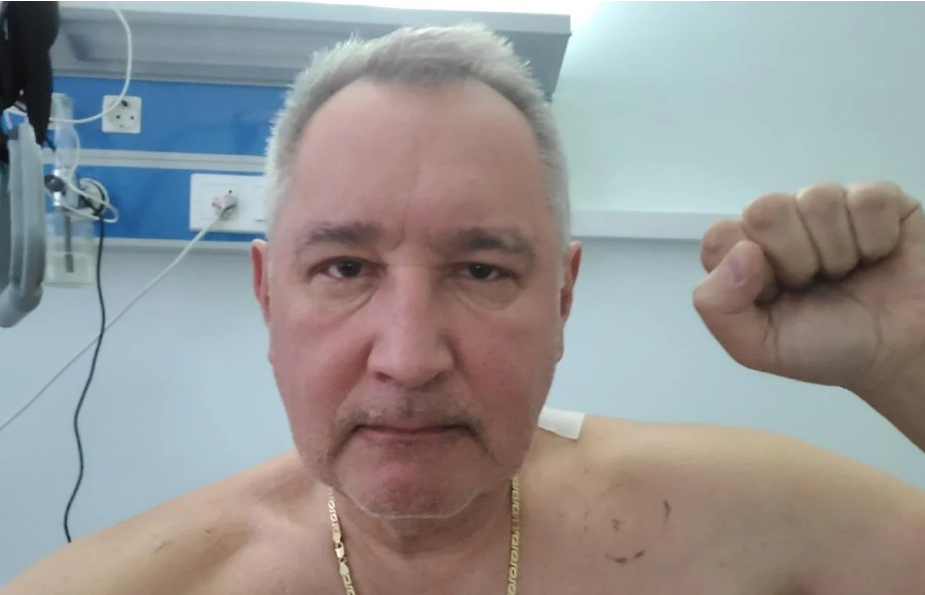 Поранений у Донецьку Рогозін опублікував перше фото з лікарні