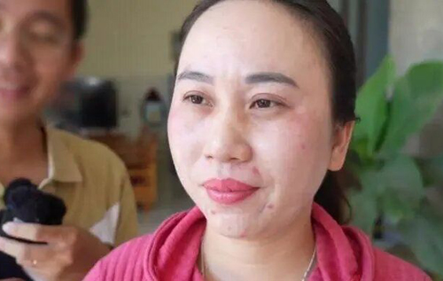 У В'єтнамі жінка не спить вже понад 11 років: як вона живе