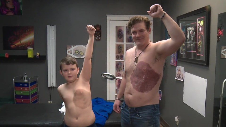 Батько року. Чоловік 30 годин набивав татуювання у вигляді великої родимої плями, щоб позбавити свого сина від комплексів.