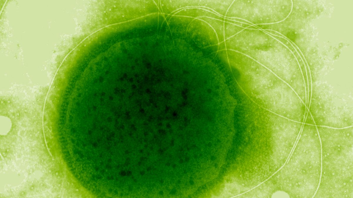 Супергерой безодні: вчені знайшли мікроорганізм, здатний вижити під дією смертельної радіації Супергерой безодні: вчені знайшли мікроорганізм, здатний вижити під дією смертельної радіації