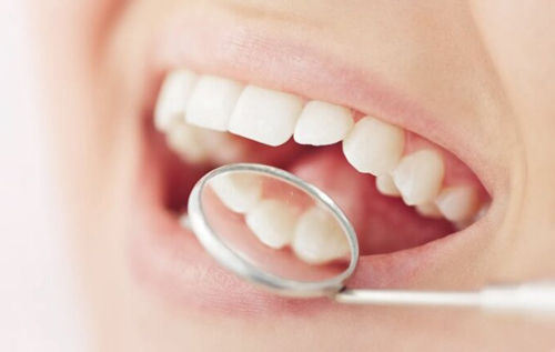 Очищають емаль: стоматолог назвав корисні для зубів продукти
